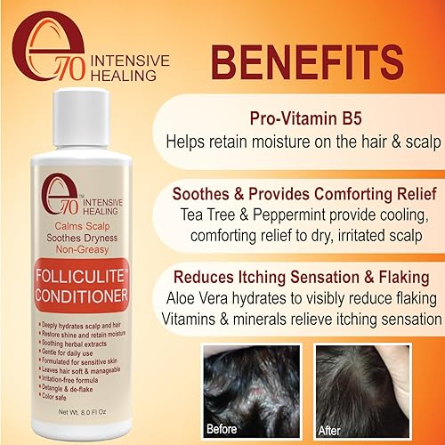 Miniatura 10 de Tratamiento de foliculitis suero aclarador con ácido salicílico para eliminar la acumulación, para cuero cabelludo normal a graso. Propenso a