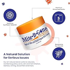 Human Mite Treatment Cream 2oz | Max-Strength 10x Sulfur Cream for Skin Mites, Bites, & Itching | Child & Adult Safe | Fast Relief for All Skin Types by Mite-Be-Gone