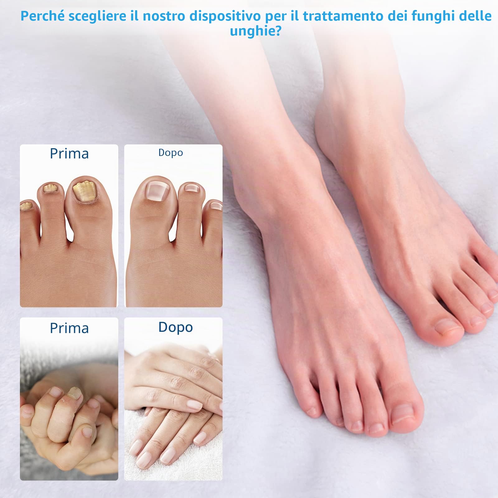 iKeener Smalto Trattamento Funghi Delle Unghie,Dispositivo Portatile Terapia Laser Freddo Pulizia Delle Unghie,Forniture Ricaricabili Cura Dita,Dei Piedi,Domestico,Indolore,Cura Dell'onicomicosi
