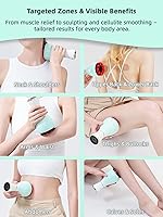 Vista 5 de Kit de ventosas eléctricas para terapia de masaje con calor, herramienta de masaje para celulitis, masajeador de drenaje linfático, alivio del dolor