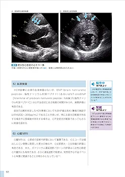 循環器診療コンプリート 心筋症 (循環器診療コンプリート