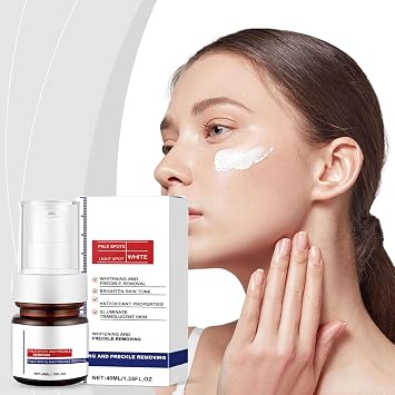 Aobenz Dark Spot Remover for Face & Body, Advanced Corrector Serum for Age Spots,Natural Ser-um,Brightening Skin nursed Ser-um for All Skin Types, Freckle Removal Cream, Anti-Spot Serum (1pcs)