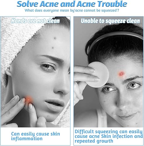 Miniatura 4 de WLLHYF Juego de 60 unidades de removedor de manchas de puntos negros, herramienta azul ABS, eliminación de comedones, removedor de puntos negros,