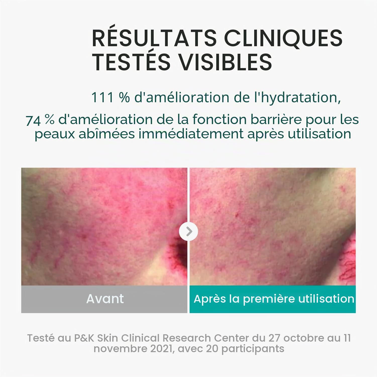 REJURAN Ampoule De Soin Hydratant, Sérum Visage Hydratant Intense Pdrn Pour Une Hydratation Instantanée Et Longue Durée, 1,01 fl oz (paquet de 1)