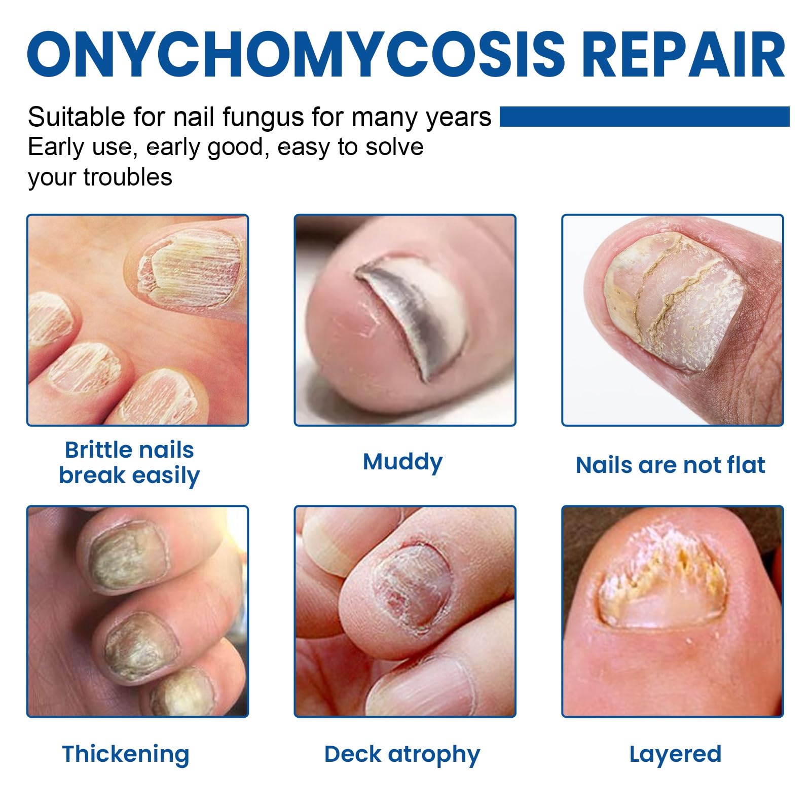 Nail Repair Oil, Extra Strong Nail Care Serum for Toenail, Nail Strengthener Oil, Fix & Renew Damaged - Image 2