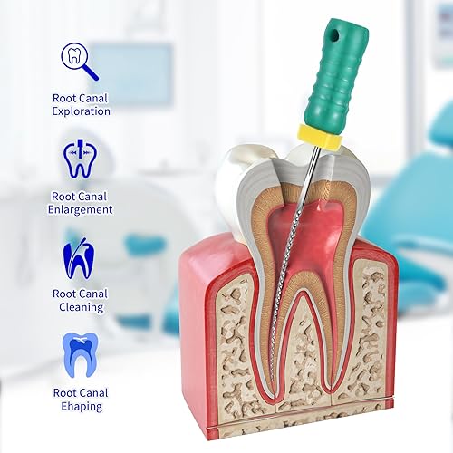 Miniatura 3 de Annhua Limas K de endodoncia de acero inoxidable de 0.98 pulgadas con varios tamaños, limas endodónticas endodónticas endodónticas para tratamiento
