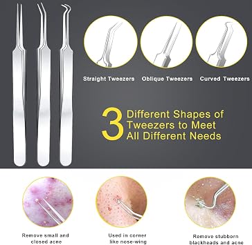Blackhead Remover Tool, Boxoyx 10 Pcs Professional Pimple Comedone Extractor Popper Tool Acne Removal Kit - Treatment for Pimples, Blackheads, Zit Removing, Forehead,Facial and Nose(All Silver)