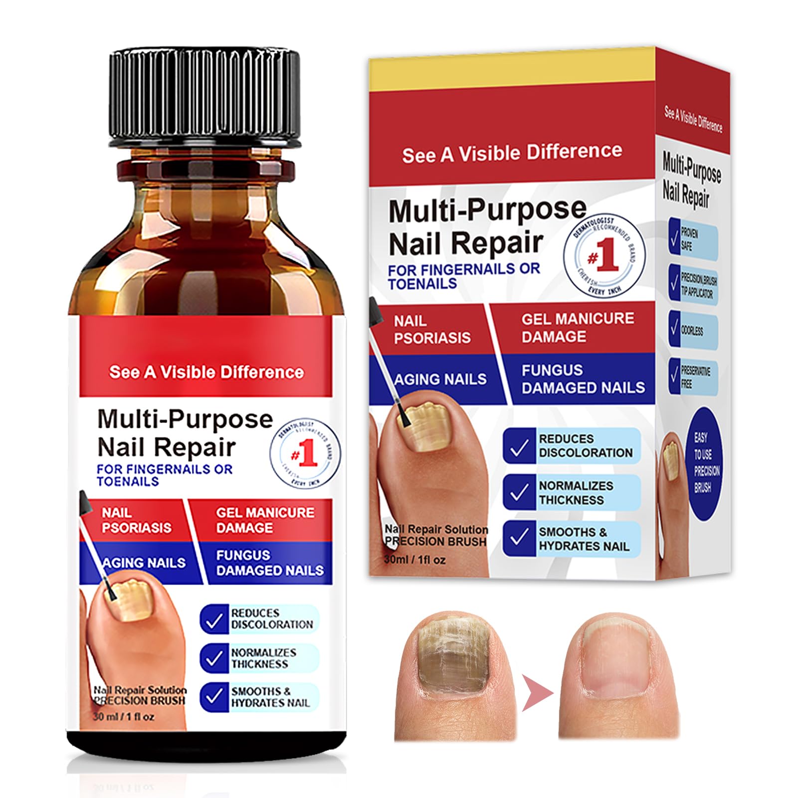 30ml Soluzione per la Cura Delle Unghie,Proteggi e Rigenerate per Unghim Piede,Rinforzante Unghie Fragili,Rinforza la Struttura Dell'unghia Nutre e Lenisce Le Unghim