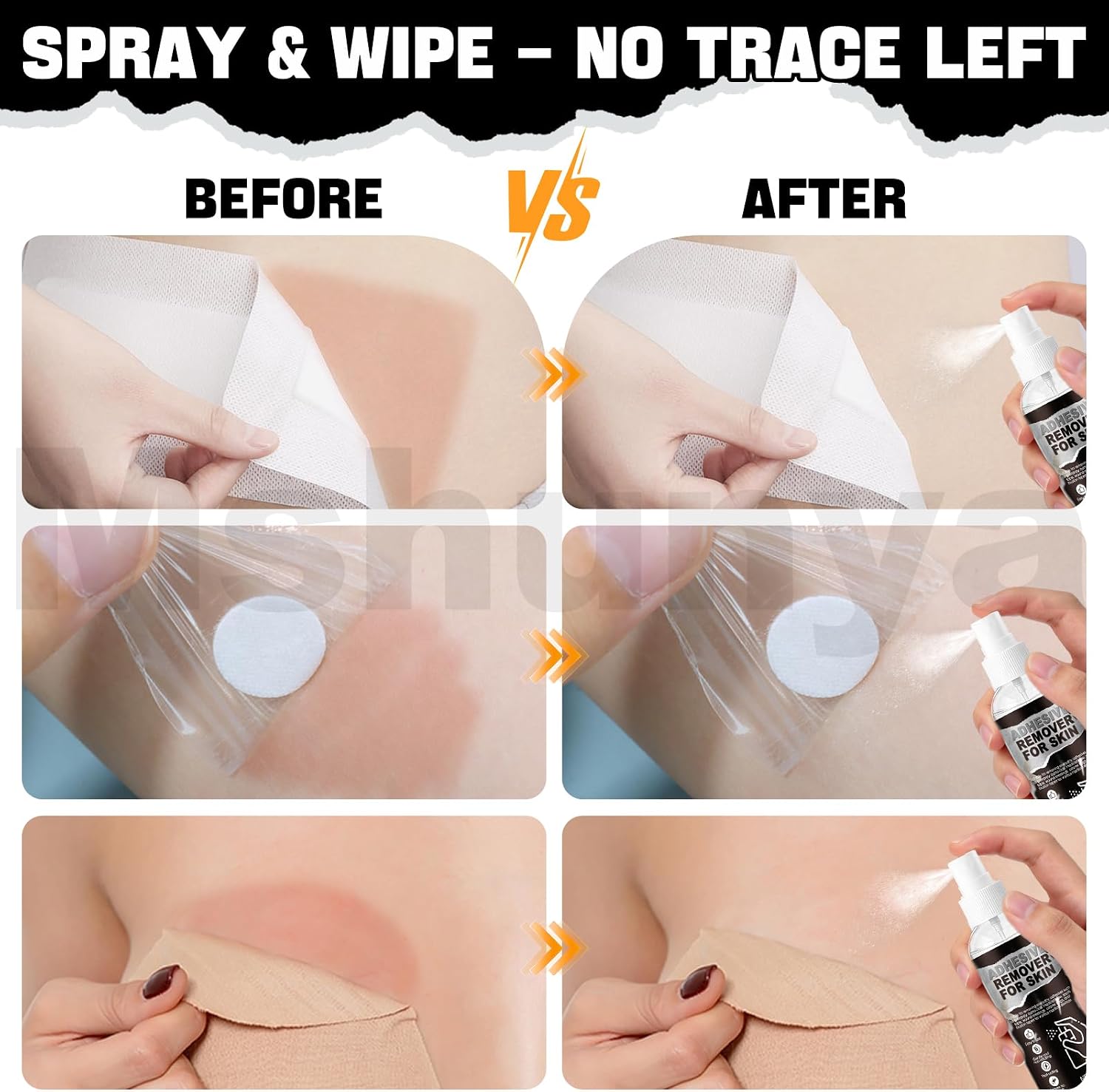 4.06 Oz Medical Adhesive Remover, Skin Adhesive Remover Gentle Fast Removal | Adhesive Remover for Skin, Gentle and Non-irritating for Silicone Adhesive, Bandage, Tape and Ostomy Residue