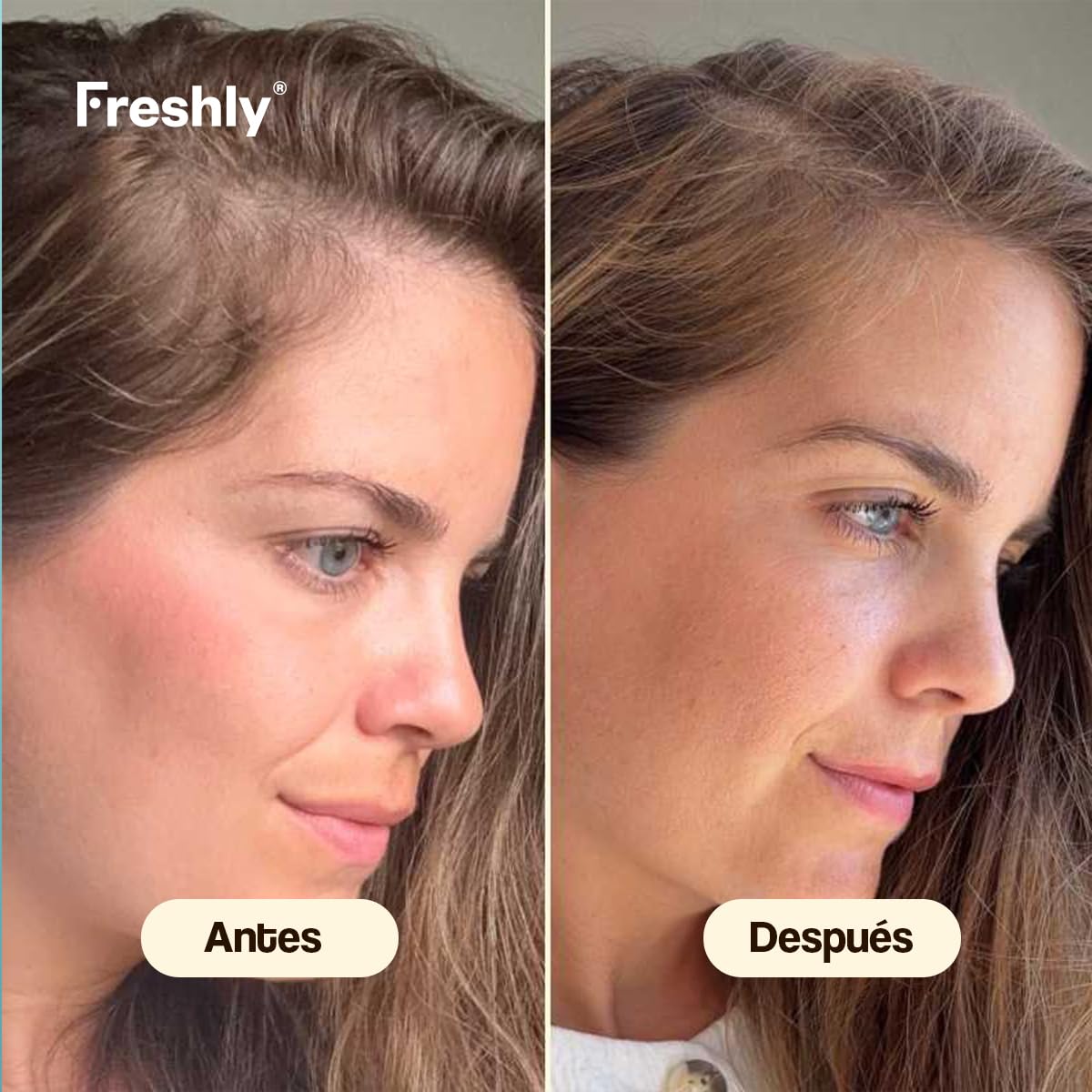 Freshly - Hair Growth & Density Anticaída Pack – Rutina Capilar Natural Anticaída – Champú + Tratamiento Sérum – Fortalece y Mejora Densidad del Cabello – Fórmula 99% Natural