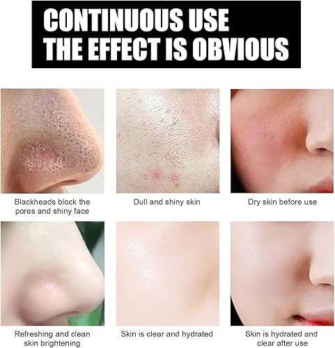 Miniatura 3 de Retinol Snake Venom - Máscara dorada rejuvenecedora, mascarilla dorada antienvejecimiento, máscara facial dorada con retinol y péptido de veneno de