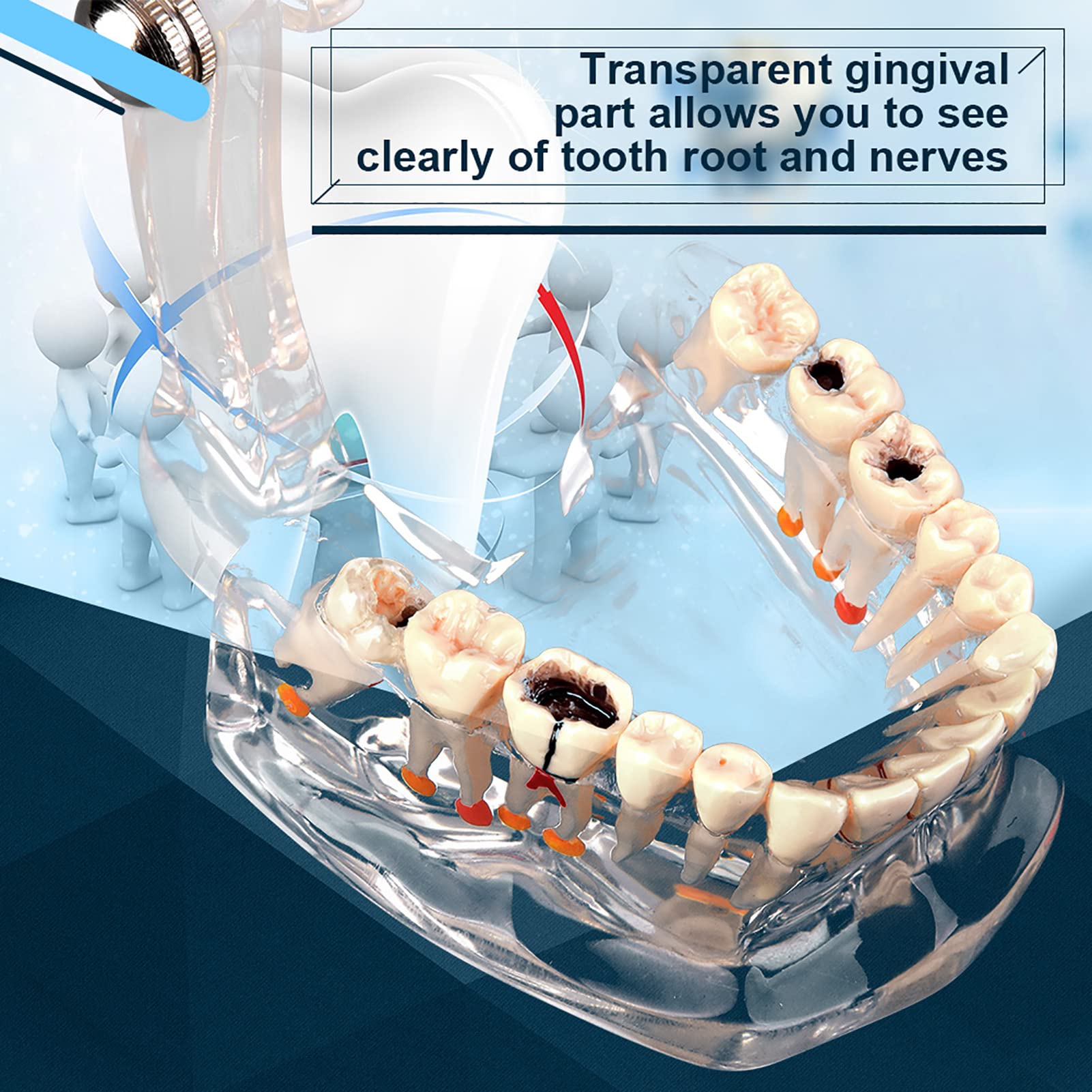 Modelo de Dientes Estándar para Estudiantes de Odontología, Herramienta Educativa Transparente