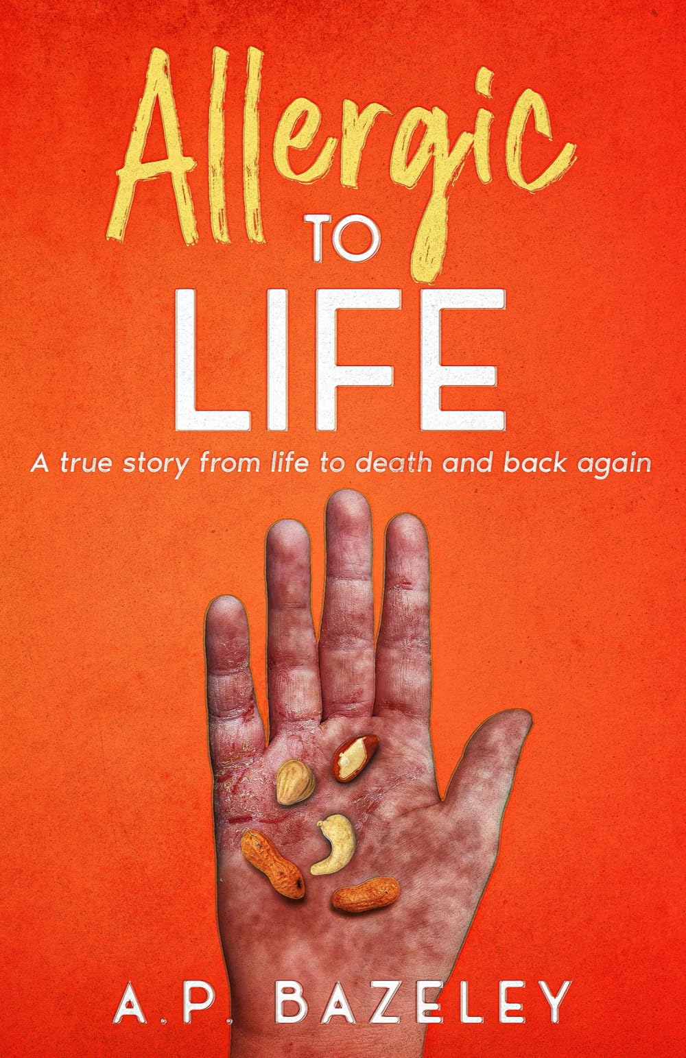 Allergic to Life: A true story from life to death and back again