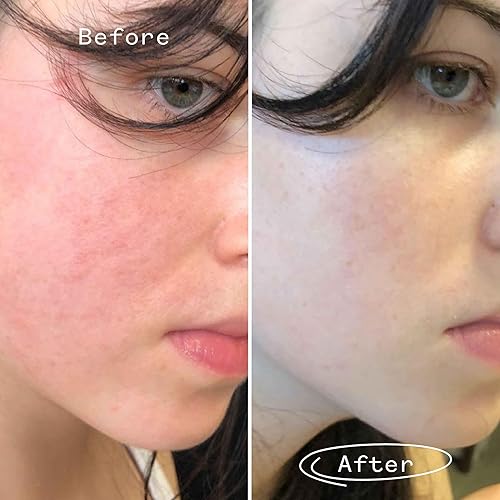 Miniatura 6 de PAI SKINCARE - The Light Fantastic Aceite facial de ceramida orgánica  Natural, vegano, cuidado de la piel sensible (1 onza líquida, 1.0fl oz)