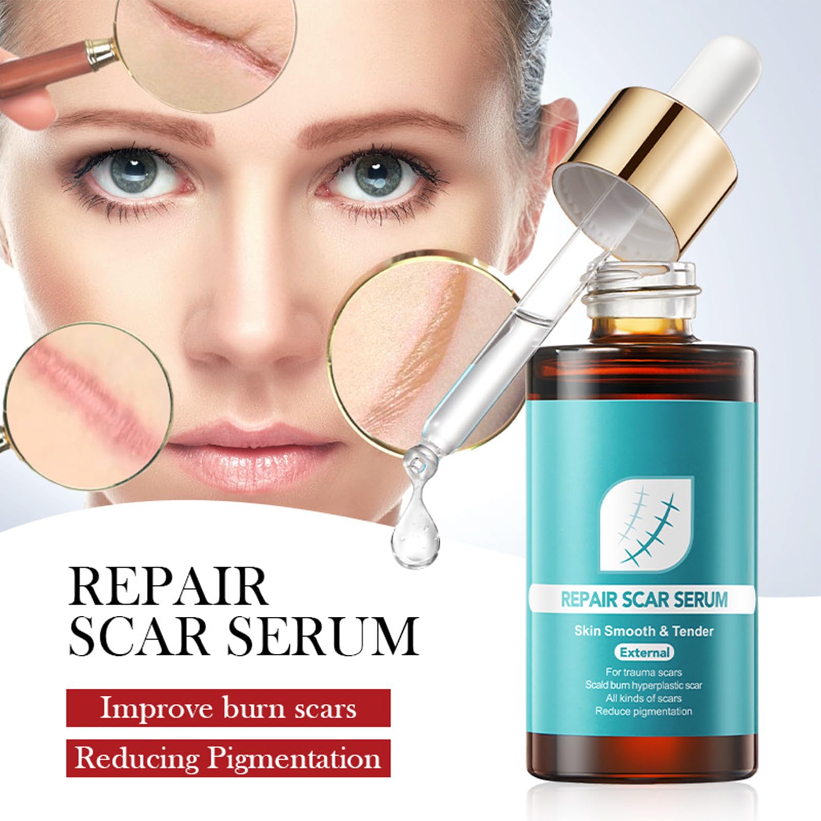 Serum do blizn, serum na blizny, serum na rozstępy, łagodniejsze blizny, bardziej elastyczne i mniej widoczne, stare i nowe blizny, usuwanie blizn
