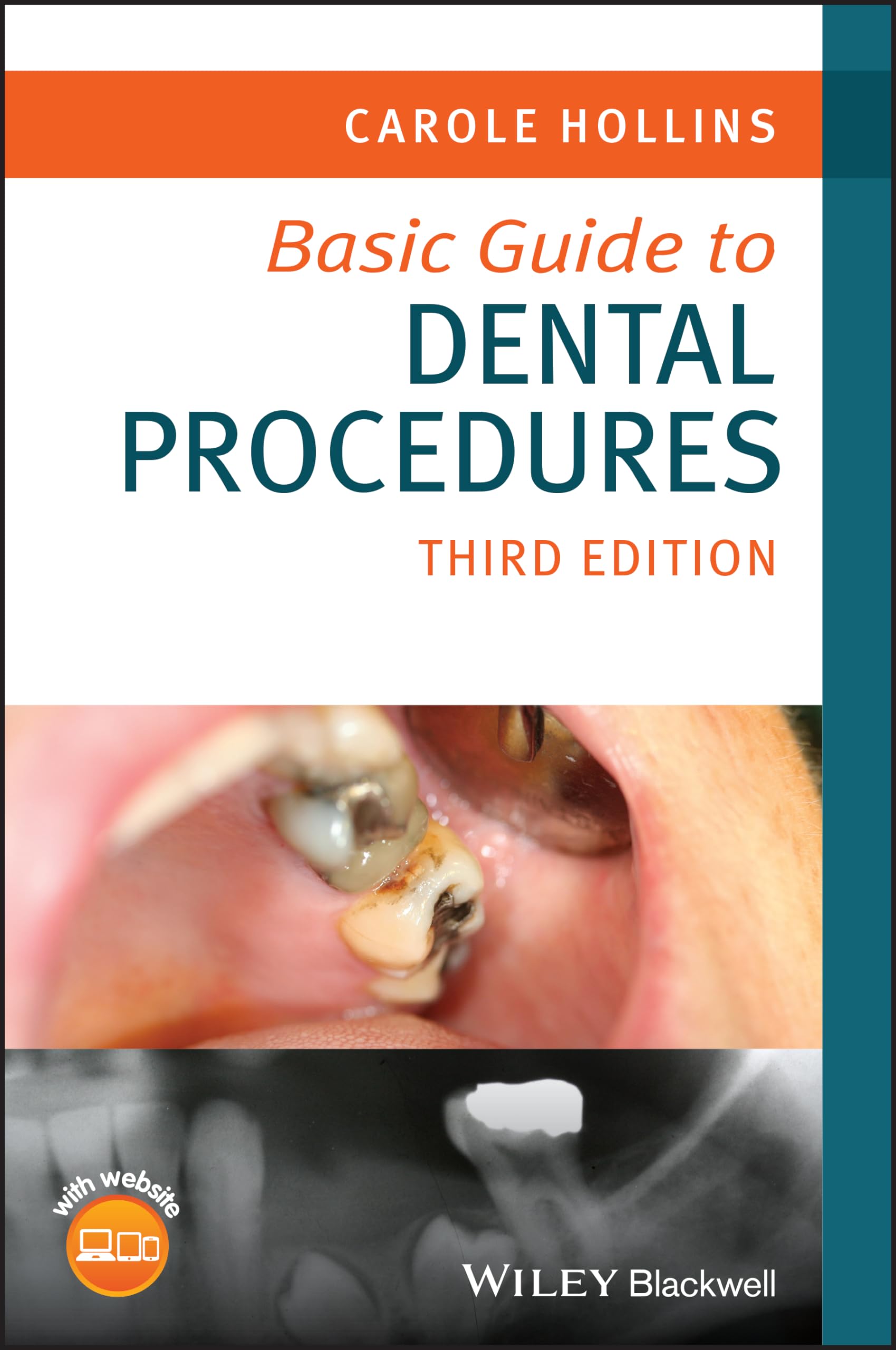 Basic Guide to Dental Procedures (Basic Guide Dentistry Series)