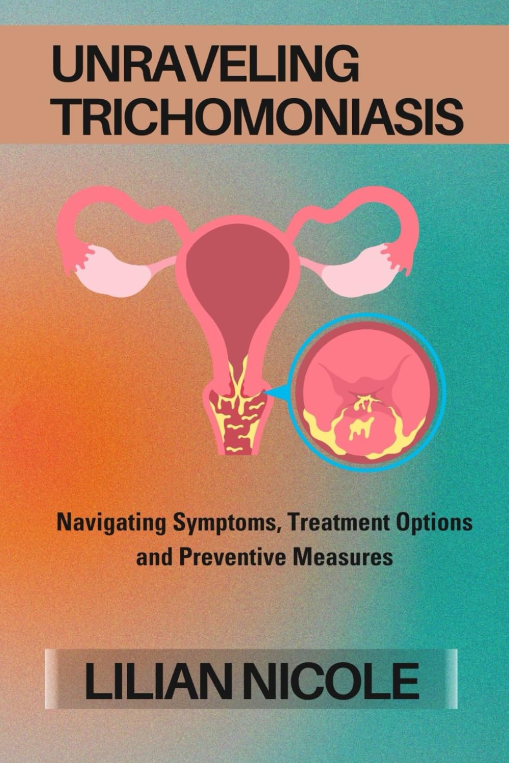 UNRAVELING TRICHOMONIASIS: Navigating Symptoms, Treatment Options and Preventive Measures