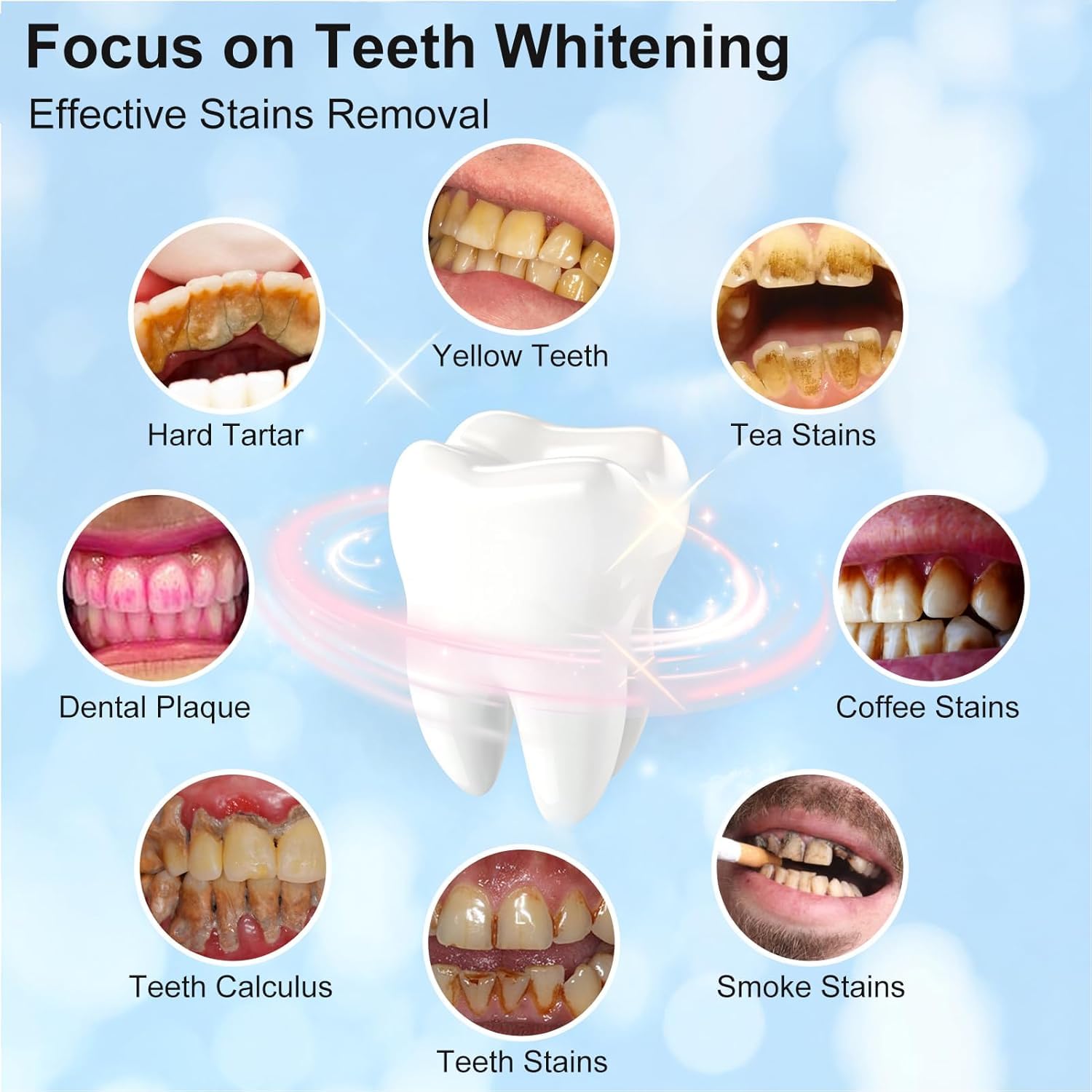 Set di Sbiancamento dei Denti, Kit per Pulizia dei Denti Elettrico,Lucidare Dopo la Pulizia,Sbiancamento, Riduce la Placca Nero