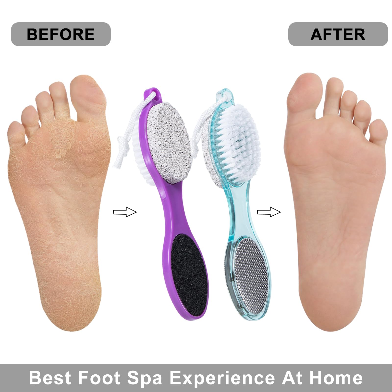 Spazzola in pietra pomice per piedi 4 in 1, scrubber per piedi doccia, lima per piedi, rimozione calli, raspa per piedi e carta abrasiva, strumenti per pedicure con manico, piedi morbidi e