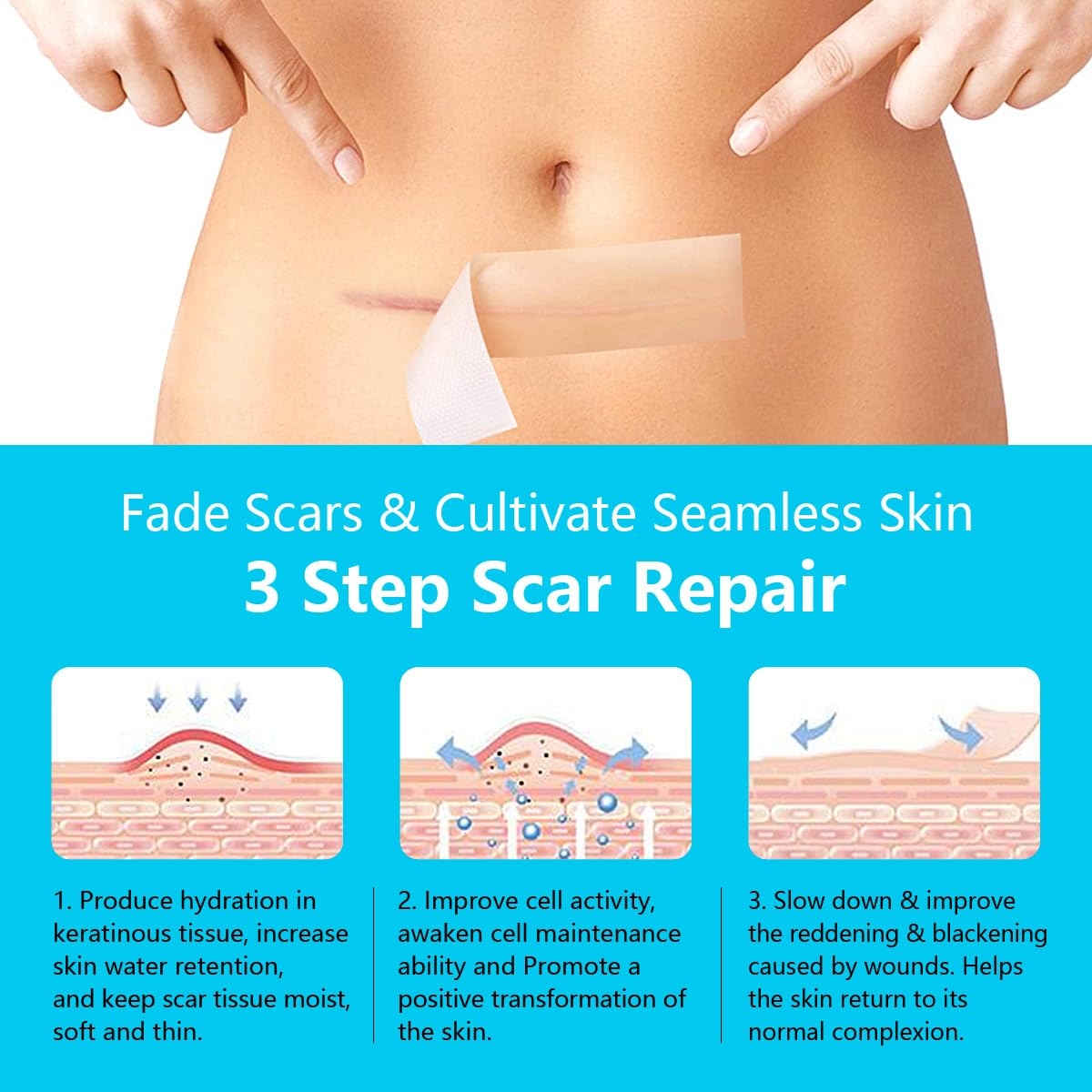 Medical Grade Silicone Scar Sheets (1.6"x60" Roll) with NDC - Breathable & Adjustable Strips for Surgical, C-Section, Burn & Hypertrophic Scars - Image 5