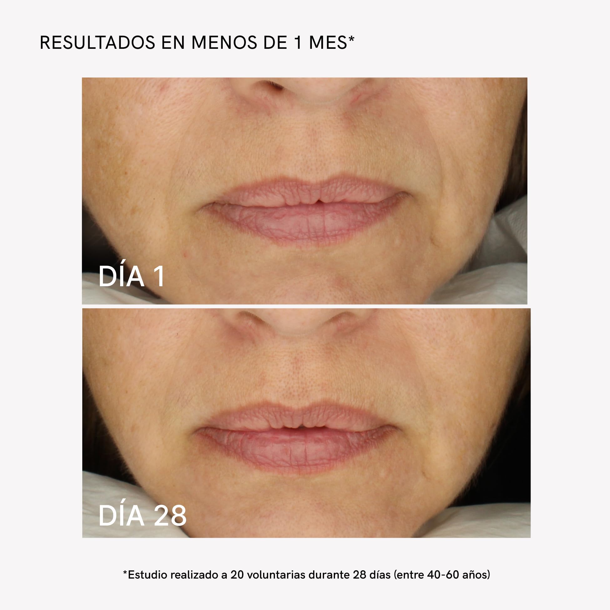 MASDERM - Crema Facial Reafirmante Radiofrecuencia 1000ml con Bio-Retinol y Colágeno para Piel Madura Mejora la Apariencia de la Firmeza Formato XL Larga Duración