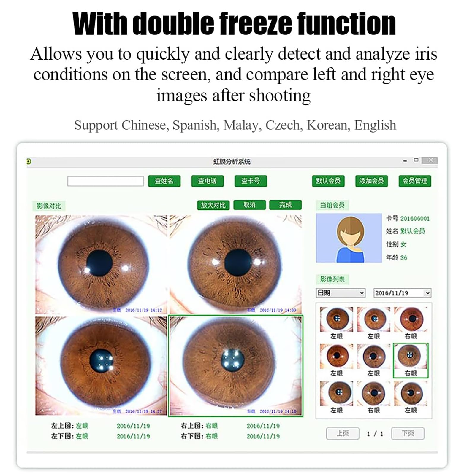 Dispositivo per L'analisi Dell'iride, Analizzatore Dell'iride con Software di Analisi Intelligente Associato E Obiettivo 30X da 5 Milioni di Pixel, Messa a Fuoco Regolabile E Scientifico
