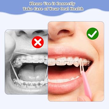 500pcs Orthodontic Elastic Bands, Braces Bands, Braces Elastic Bands, Brace Bands for Teeth, Teeth Bands for Gaps, Dental Elastic Rubber Bands (Fox 1/4)