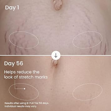 MAELYS B-FLAT Belly Firming Cream for Women - Skin Tightening & Moisturizing Treatment with Shea Butter & Bentonite Clay - Smooths Look of Stretch Marks - Postpartum Body Care (3.4 Fl Oz)