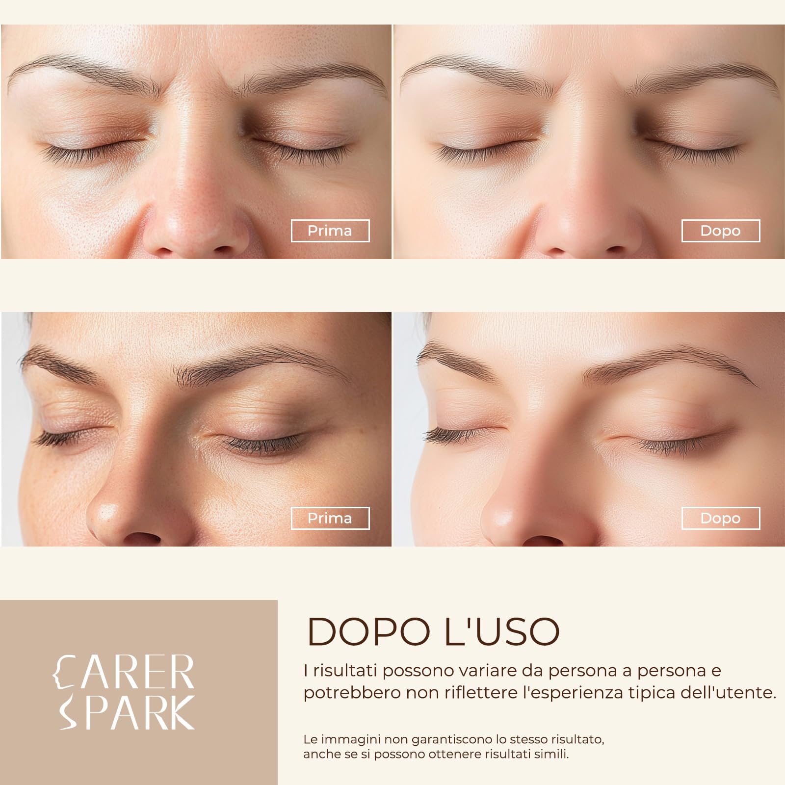 CARER SPARK Peeling Ultrasonico Facial – Spatola Viso a Ultrasuoni EMS Ioni Luce Rossa e Blu 4 Modalità per Pulizia Profonda Rimozione Comedoni Esfoliazione Delicata
