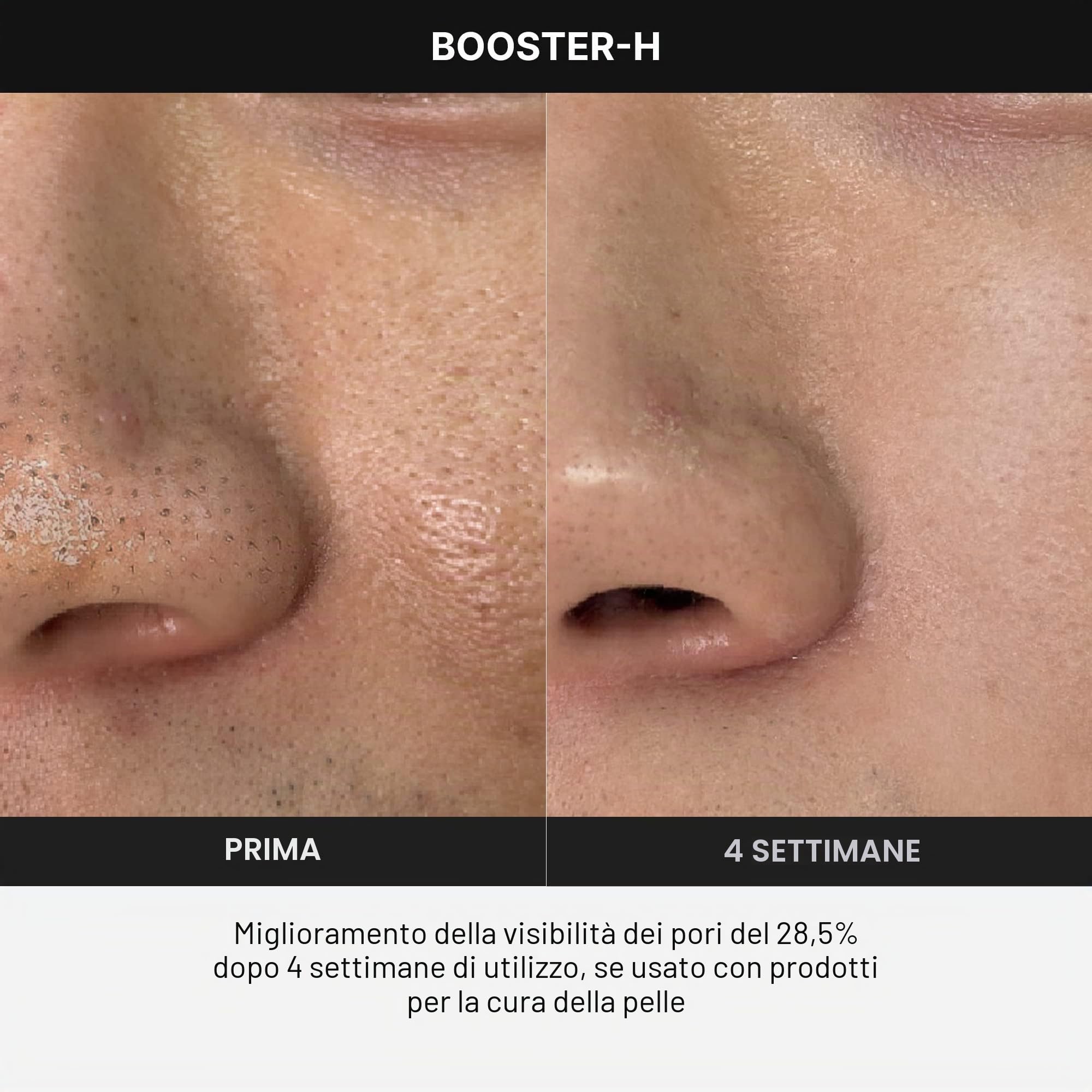 Medicube Age-R Booster H - Dispositivo coreano No.1 per la cura della pelle, booster luminosità facciale senza aghi