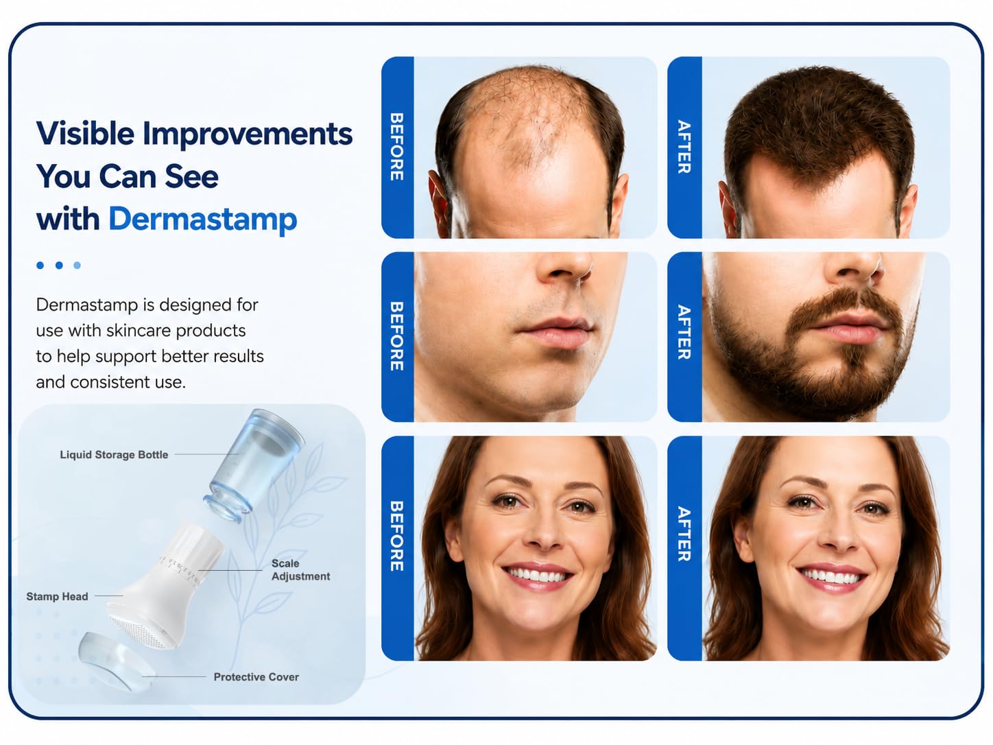 Healthcons S2 Upgraded Derma Stamp 140 | Adjustable Microneedle Serum Applicator with 10ml Refillable Bottle | Hydra Derma System for Enhanced Absorption & Skin Refresh | Face & Scalp Use 1
