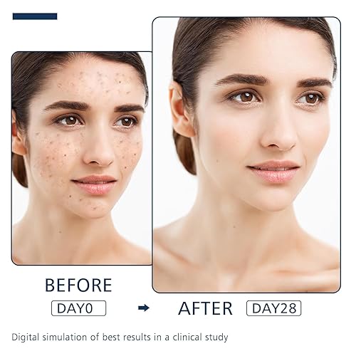 Miniatura 5 de Eliminador de manchas oscuras para cara y cuerpo  Suero corrector avanzado de manchas oscuras para melasma, manchas de la edad, pecas y manchas