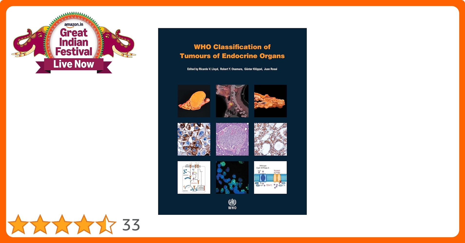 Who Classification of Tumours of Endocrine Organs (World Health Organization Classification of Tumours) [ペーパーバック] Lloyd， Ricardo V.、 Osamura， Robert Y.、 Kloppel， Gunter; Rosai， Juan World Health Organization Classification of Tumours of