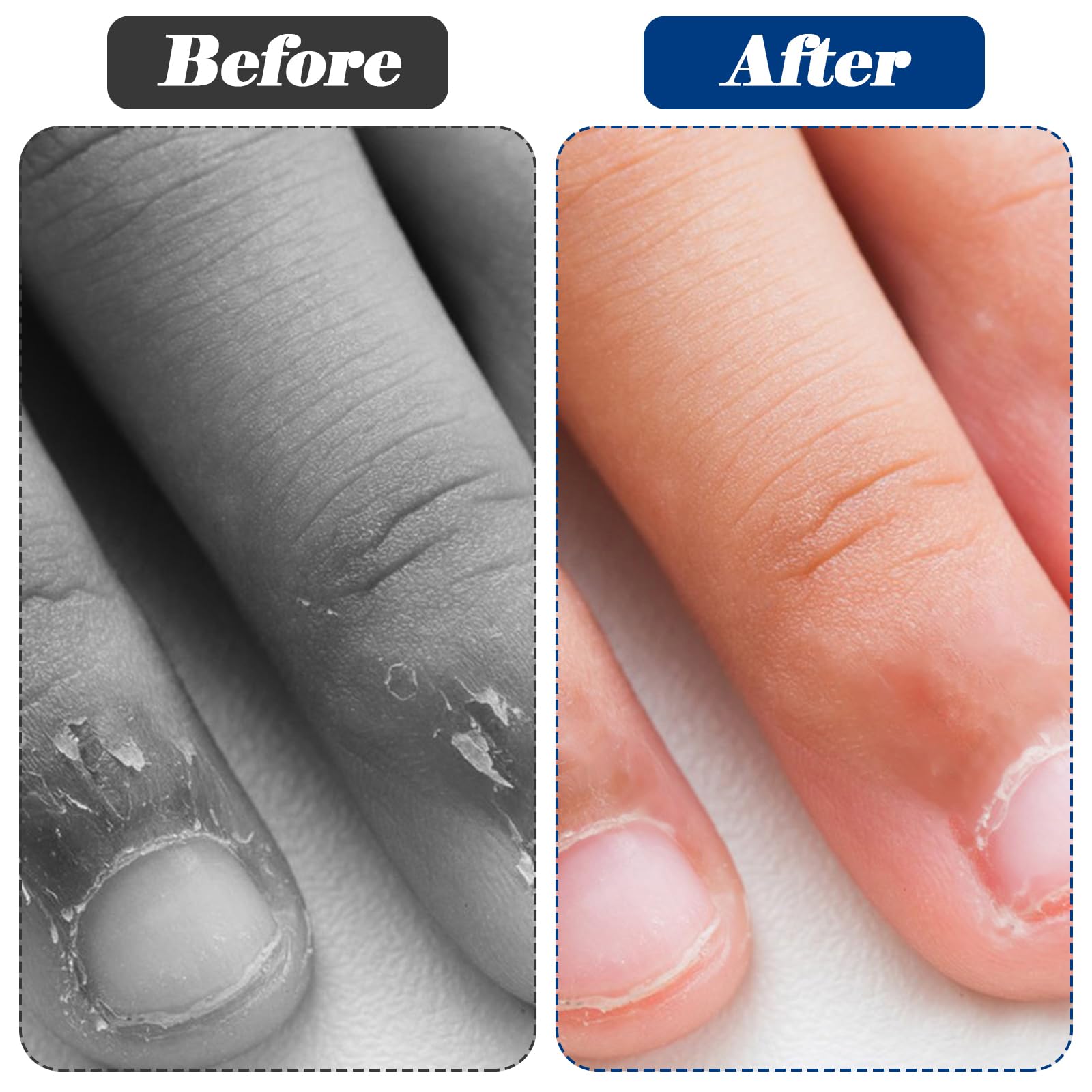 JJUNW Pinza per cuticole per unghie in acciaio inossidabile, pinzette piccole per cuticole, forbici dritte per cuticole, punte affilate, taglierina angolare, taglierina cuticole per unghie, strumento