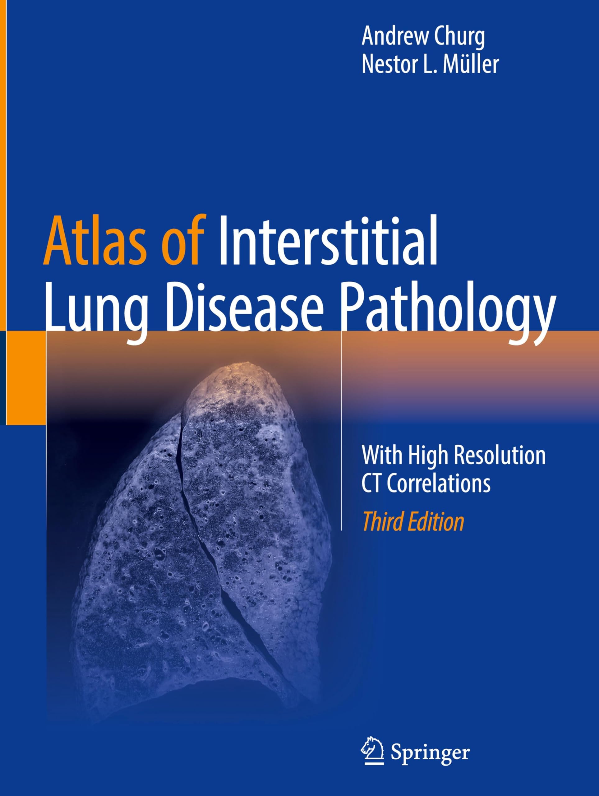 Atlas Of Interstitial Lung Disease Patho
