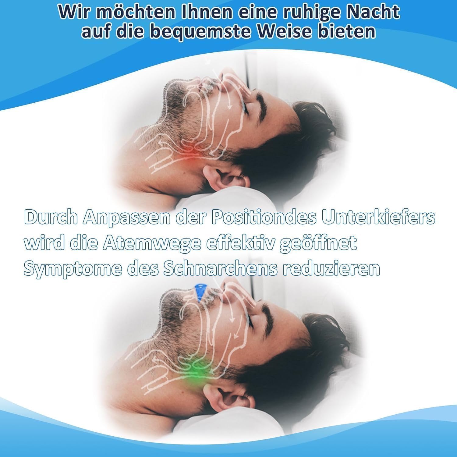 Schnarchstopper, Ergonomisch Schnarchschiene für Männer und Frauen, Effektiv Anti Schnarch Schiene Snoring Stopper, Kein BPA, Extra Weich, Gebrauchsfertig für Schnarchfreien Schlaf Nacht