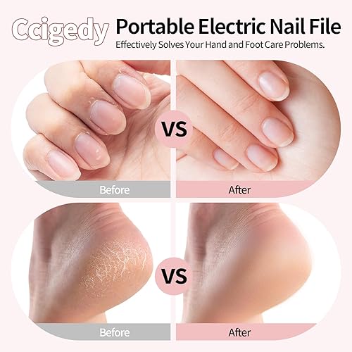 Miniatura 2 de Kit de molinillo eléctrico profesional de manicura y pedicura para uñas de los pies, juego de limas eléctricas inalámbricas para uñas gruesas,