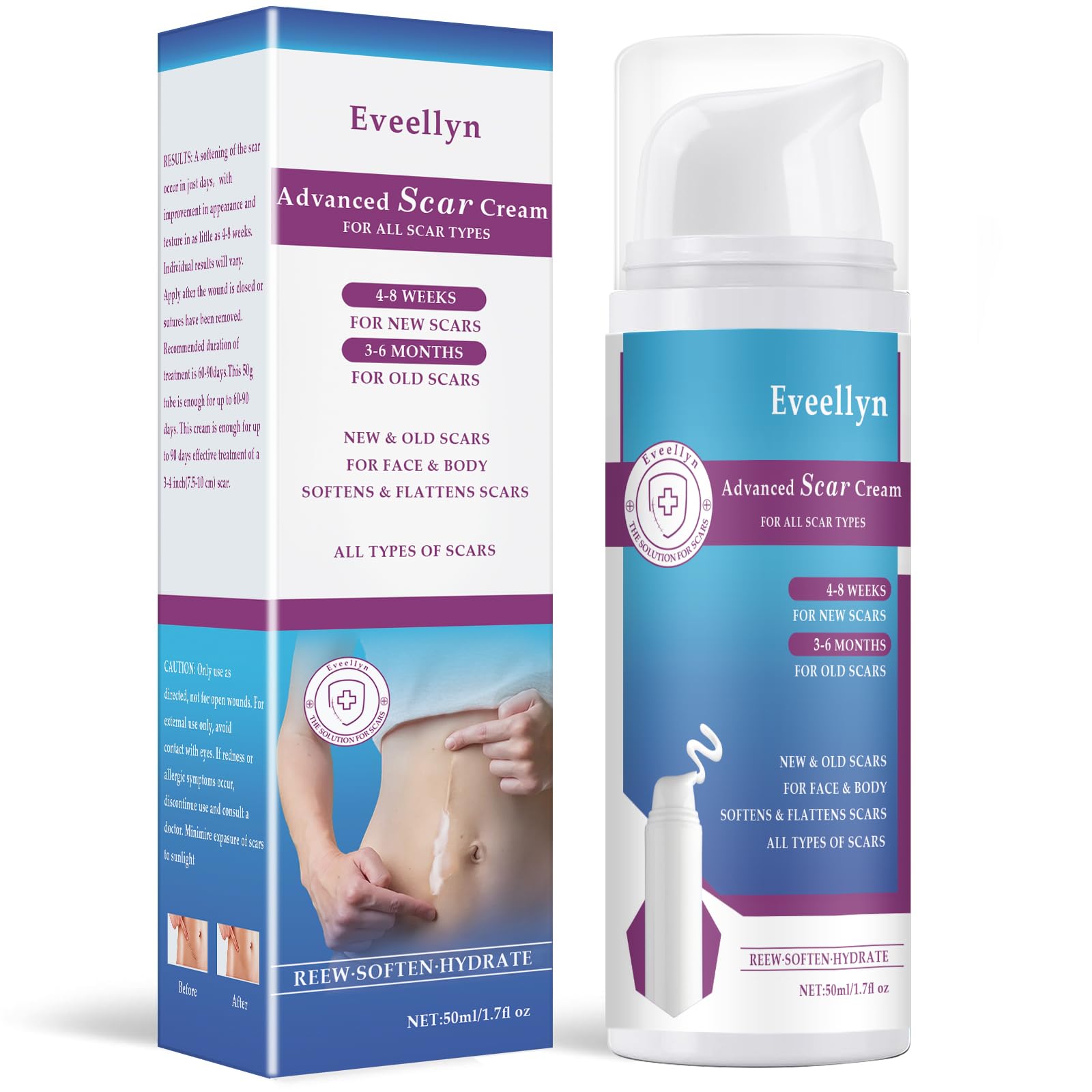 Scar Cream, Scar Gel, Professional Scar Removal Cream for Surgical Scars, Stretch Mark, Keloid Bump, C-Section, Burn, Acne, Old and New Scars 1.7 oz (50g), White