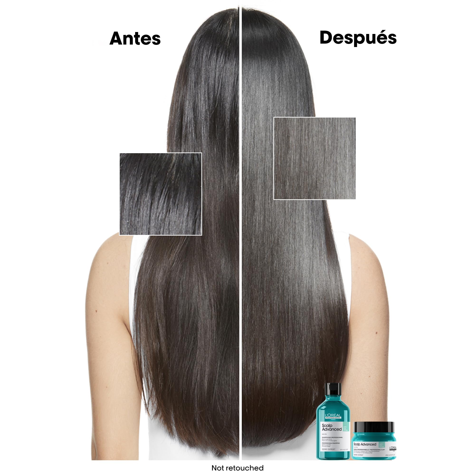 L'Oréal Professionnel Haarshampoo zur Reinigung fettiger Kopfhaut, Scalp Advanced, Anti-Oiliness Dermo-Purifier Shampoo, 300 ml - Image 3