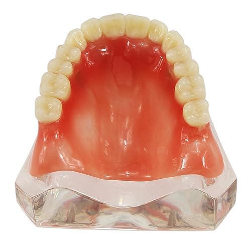 Miniatura 6 de Modelo de sobredentadura dental con 4 dientes superiores Demo Visión transparente para educación y estudio modelo herramienta M6001 C