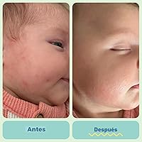 Vista 5 de TUBBY TODD Pomada para Todo - Crema para Eczema de Bebé, Crema Multiusos para Piel Sensible, Seca e Irritación de Bebé, Libre de Esteroides
