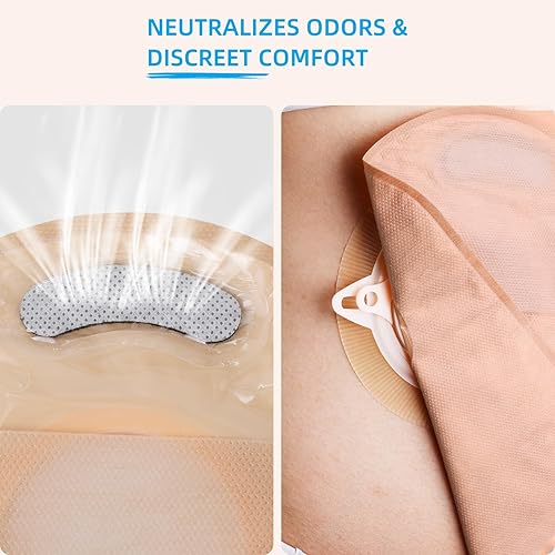 Miniatura 5 de Bolsas de colostomía Sistema convexo de dos piezas  Bolsas de ostomía Suministros de ostomía Bolsas drenables con hebilla de cinturón  15 bolsas + 6