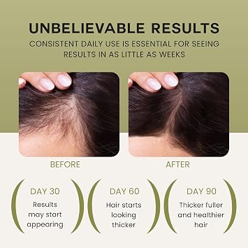 Lebanta Batana Oil For Hair Growth - 100% Pure, Raw & Natural Blend With Organic Castor, Pumpkin Seed, Coconut and Rosemary Oil - Thicker, Stronger Hair For Men & Women Scalp (3 Pack)