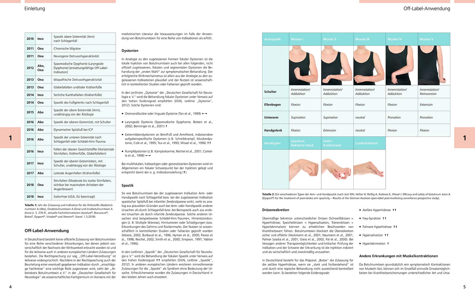 Atlas der Botulinumtoxin-Injektion: Dosierung | Lokalisation | Anwendung