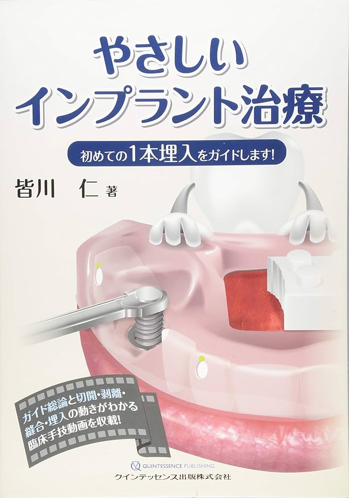 やさしいインプラント治療 初めての1本埋入をガイドします! やさしいインプラント治療 | 皆川 仁 |本 | 通販 | Amazon
