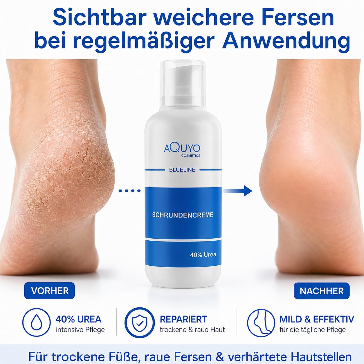 Blueline Schrundencreme 40% Urea, Fußcreme zum Hornhaut entfernen (500ml) | Creme für rissige Fersen und Füße, zur Behandlung von Schrunden an Händen, Ellenbogen oder Füßen