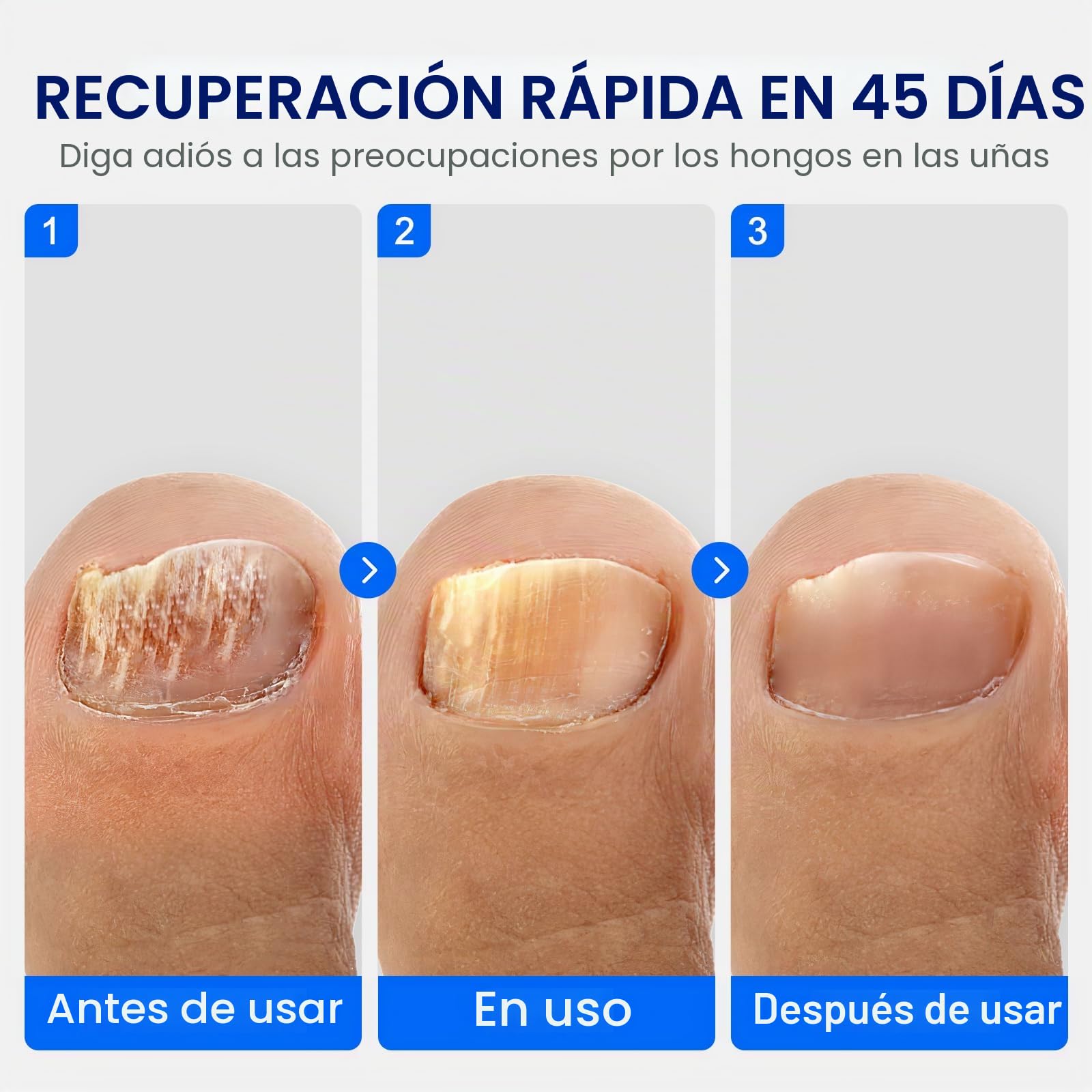 Aparato para el cuidado de las uñas (de pies y manos)