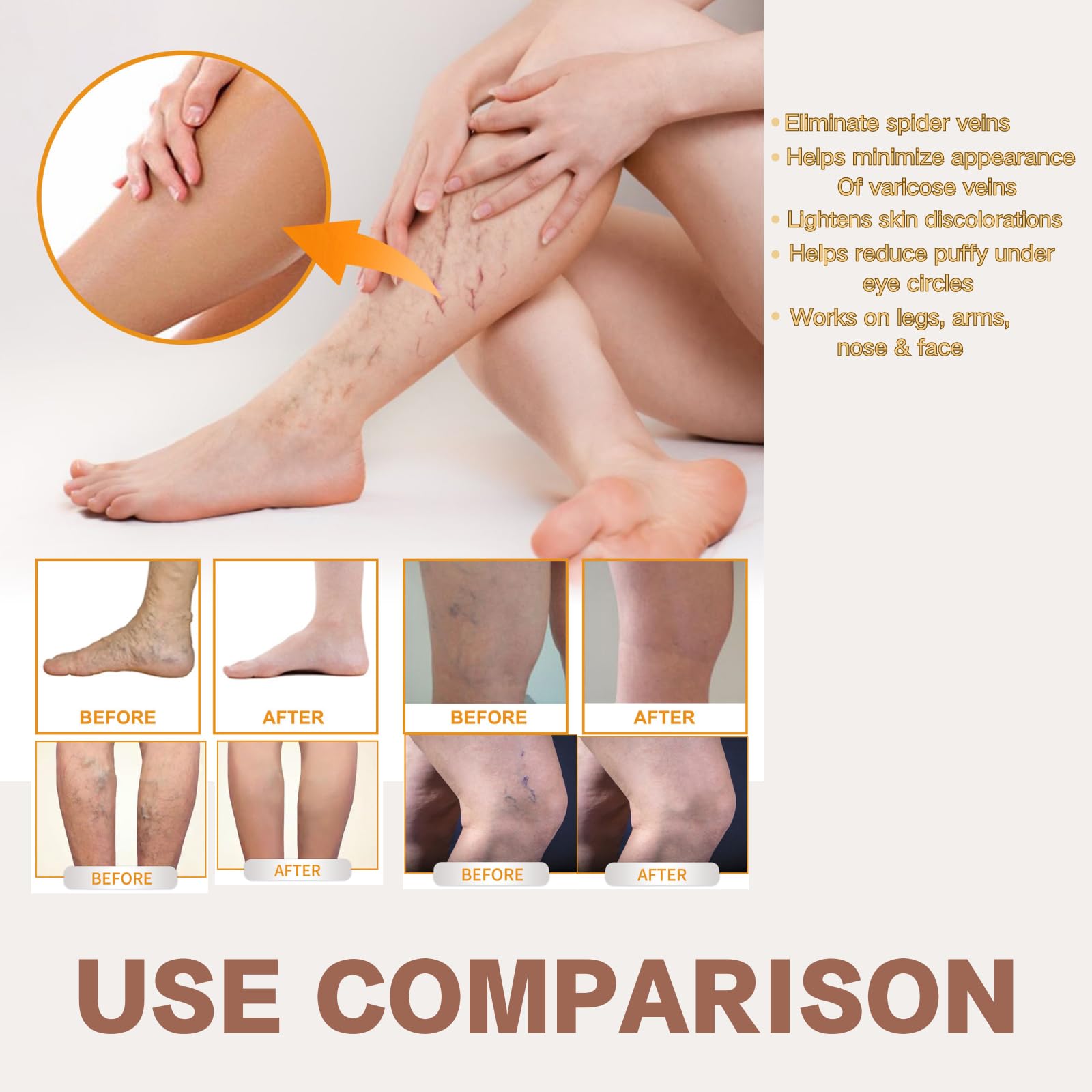 2PCS Varicose Veins Miracle Cream With Vitamin K - Suitable for Legs and Face, All Skin Types, Deeply Nourishing and Moisturizing