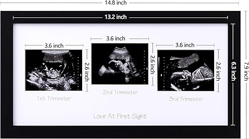 Miniatura 10 de eletecpro Marco de fotos de ultrasonido, para pantalla de fotos de ecografía de 3 x 4, marcos de fotos de sonograma para anuncio de embarazo,