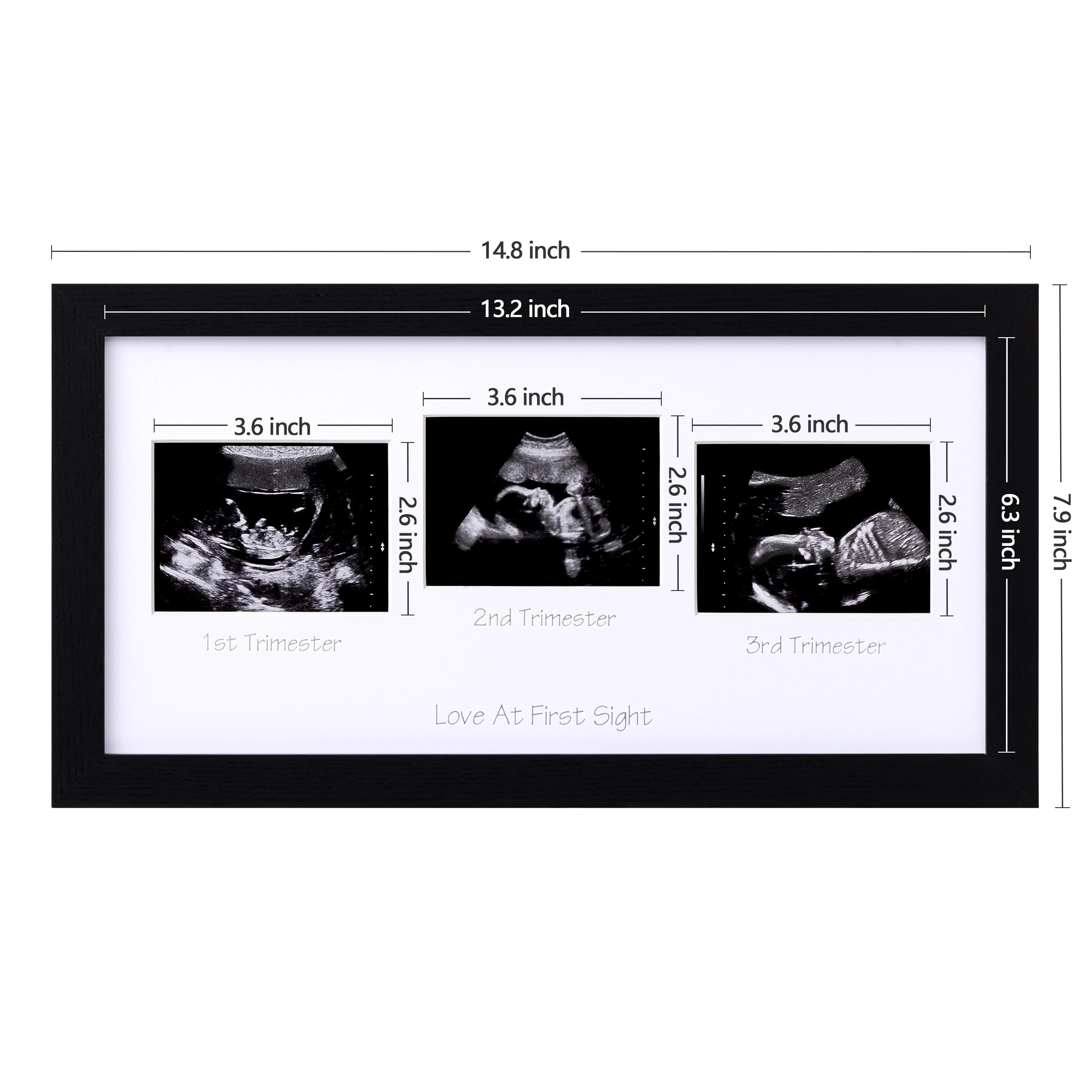 Eletecpro Triple Ultrasound Picture Frame, Display 34
